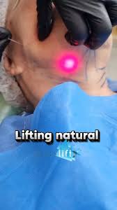 Procedimiento estético facial - Logana Medical Spa