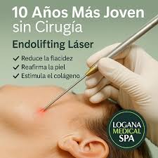 Resultados de tratamiento clínico - Logana Medical Spa